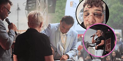 Brutalne POBICIE w Polanowie. Policja zabezpieczyła monitoring. Było za mało radio