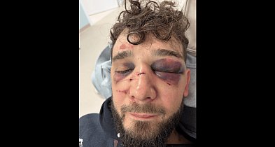 Zobaczcie co zrobiliście! BRUTALNE POBICIE po święcie miasta. 6 na 1