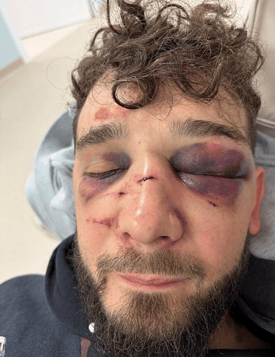 Zobaczcie co zrobiliście! BRUTALNE POBICIE po święcie miasta. 6 na 1