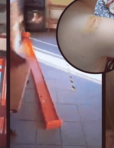 WYPADEK w szpitalu. Na 3-letnie dziecko spadła osłona w izbie przyjęć